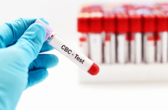 The Importance of CBC Blood Test for Monitoring Overall Health